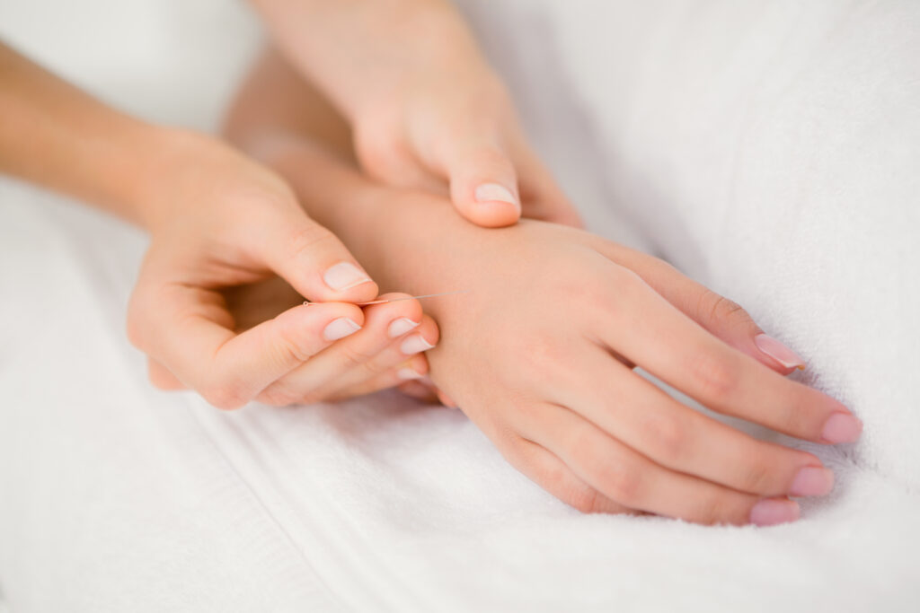 acupuncture-treatment-for-mental-health-san-diego